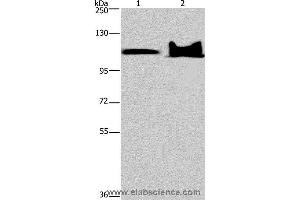 Western blot analysis of Mouse heart and brain tissue, using KDM4C Polyclonal Antibody at dilution of 1:800 (KDM4C antibody)