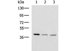 Western blot analysis of Human cerebrum tissue Human cerebella tissue Mouse brain tissue lysates using ENKD1 Polyclonal Antibody at dilution of 1:1150 (ENKD1 antibody)