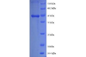 SDS-PAGE (SDS) image for Prefoldin Subunit 5 (PFDN5) (AA 2-154) protein (GST tag) (ABIN4974484)