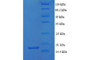 SDS-PAGE (SDS) image for Growth Differentiation Factor 5 (GDF5) (AA 376-495) protein (His tag) (ABIN4976841)