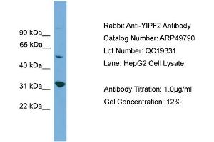 WB Suggested Anti-YIPF2  Antibody Titration: 0.