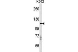 VPS11 Antibody (C-term) western blot analysis in K562 cell line lysates (35 µg/lane). (VPS11 antibody  (C-Term))