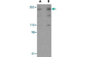 Western blot analysis of RTN4 in human brain tissue lysate with RTN4 polyclonal antibody  at (A) 0.