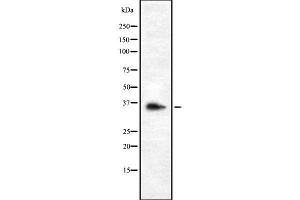 Western blot analysis OR9G1 using K562 whole cell lysates (OR9G1 antibody  (Internal Region))