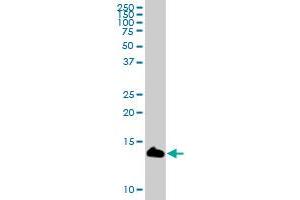 LY6D MaxPab polyclonal antibody. (LY6D antibody  (AA 1-128))
