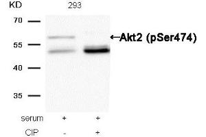 Western blot analysis of extracts from 293 cells, treated with serum or calf intestinal phosphatase (CIP), using Akt2 (Phospho-Ser474) Antibody. (AKT2 antibody  (pSer474))