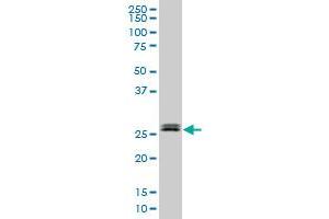 TGIF2 monoclonal antibody (M18), clone 2F3. (TGIF2 antibody  (AA 1-237))