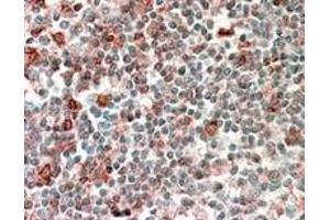 Image no. 3 for anti-Neutrophil Cytosolic Factor 4, 40kDa (NCF4) (Internal Region) antibody (ABIN374770) (NCF4 antibody  (Internal Region))