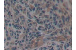 Immunohistochemistry (IHC) image for anti-Microtubule-Associated Protein tau (MAPT) (AA 130-386) antibody (ABIN7434476)