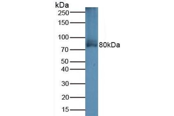 Transferrin Receptor 2 antibody  (AA 4-87)