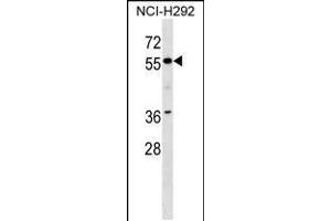 Western blot analysis in NCI-H292 cell line lysates (35ug/lane). (ZNF512 antibody  (N-Term))