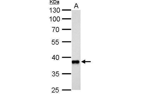 AKR1C3 antibody  (C-Term)