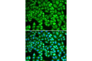 Immunofluorescence analysis of U2OS cells using WAS antibody (ABIN5970366). (WASP antibody)
