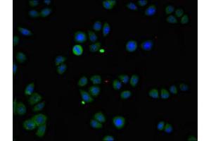 Immunofluorescent analysis of PC-3 cells using ABIN7146178 at dilution of 1:100 and Alexa Fluor 488-congugated AffiniPure Goat Anti-Rabbit IgG(H+L) (ZMPSTE24 antibody  (AA 217-347))