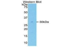 Detection of Recombinant Gallus, Human using Polyclonal Antibody to Fatty Acid Synthase (FASN) (Fatty Acid Synthase antibody  (AA 2263-2512))