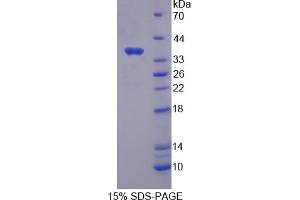 Image no. 1 for Calcium-Sensing Receptor (CASR) (AA 863-1079) protein (His tag) (ABIN6237790)