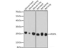 Western blot analysis of extracts of various cell lines using VEGF Monoclonal Antibody at dilution of 1:500. (VEGF antibody)
