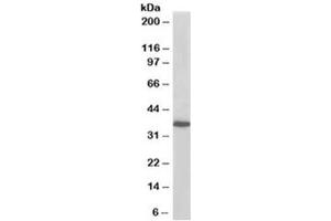 Western blot testing of A431 lysate with PDLIM4 antibody at 0. (PDLIM4 antibody)