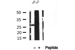Western blot analysis of extracts of HepG2 cells, using TPI1 antibody. (TPI1 antibody  (C-Term))