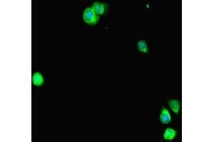 Immunofluorescent analysis of Hela cells using ABIN7169671 at dilution of 1:100 and Alexa Fluor 488-congugated AffiniPure Goat Anti-Rabbit IgG(H+L) (STAT2 antibody  (AA 571-851))