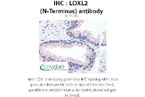 Image no. 2 for anti-Lysyl Oxidase-Like 2 (LOXL2) (N-Term) antibody (ABIN1736517)