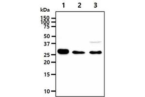 The cell lysates (40ug) were resolved by SDS-PAGE, transferred to PVDF membrane and probed with anti-human IMPA1 antibody (1:1000). (IMPA1 antibody)