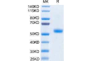 SDS-PAGE (SDS) image for CD40 Ligand (CD40LG) (Trimer) protein (His-DYKDDDDK Tag,Biotin) (ABIN7274319)