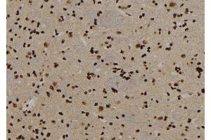 ABIN6279896 at 1/100 staining Rat brain tissue by IHC-P. (USP29 antibody)