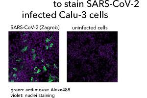 Calu-3 cells were infected with SARS-CoV-2, fixed with formaldehyde and stained with (ABIN7581774) followed by anti-mouse-Alexa488 staining and a nuclear marker. (Recombinant SARS-CoV-2 Nucleocapsid antibody  (Whole Molecule))