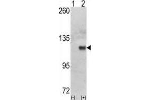 Western Blotting (WB) image for anti-Hexokinase 1 (HK1) antibody (ABIN3003712)