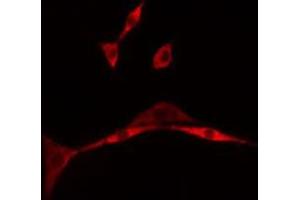 ABIN6275497 staining A549 cells by IF/ICC. (ARHGEF16 antibody  (Internal Region))