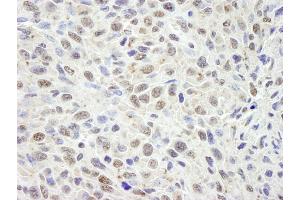 Immunohistochemistry (IHC) image for anti-Cell Division Cycle and Apoptosis Regulator 1 (CCAR1) (AA 1-50) antibody (ABIN7448463) (CCAR1 antibody  (AA 1-50))