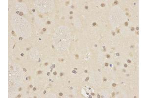 Immunohistochemistry (IHC) image for anti-Autophagy related 4A Cysteine Peptidase (ATG4A) antibody (ABIN1871138) (ATG4A antibody)