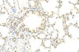 Immunohistochemistry analysis of paraffin-embedded rat lung using,IOP2 (ABIN7074883) at dilution of 1: 2000 (NARF antibody)