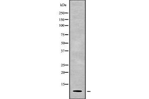 Western blot analysis of PART1 using HuvEc whole cell lysates (PART1 antibody)