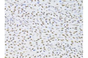 Immunohistochemistry of paraffin-embedded human adenomyosis using FKBP4 Antibody (ABIN5973289) at dilution of 1/100 (40x lens). (FKBP4 antibody)