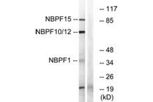 Western blot analysis of extracts from 293/HepG2/Jurkat/COLO cells, using NBPF1/9/10/12/14/15/16/20 Antibody. (NBPF1,9,10,12,14,15,16,20 (AA 121-150) antibody)
