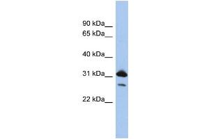 WB Suggested Anti-RAP1B  Antibody Titration: 0.