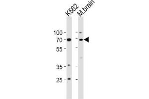 Western Blotting (WB) image for anti-Tumor Protein P73 (TP73) antibody (ABIN3003949) (Tumor Protein p73 antibody)