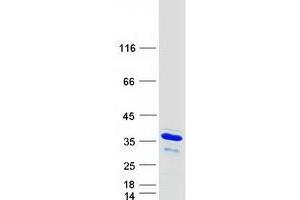 Validation with Western Blot