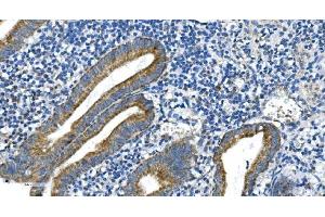 IHC analysis of DRP1/DNM1L using anti-DRP1/DNM1L antibody (ABIN7602180).