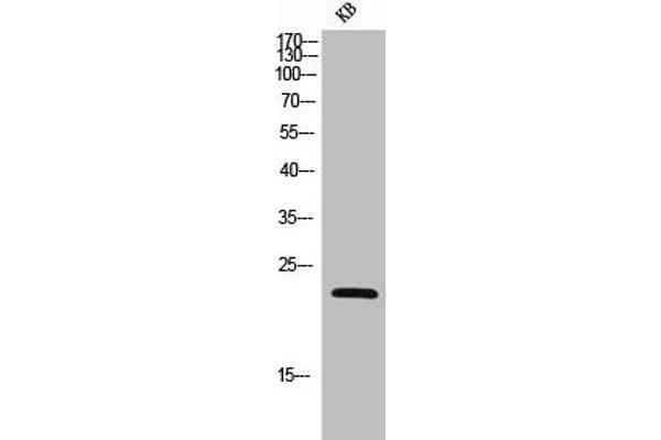 NCR3 antibody  (Extracellular Domain, Transmembrane Domain)