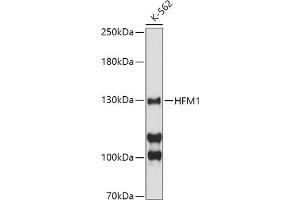 Western blot analysis of extracts of K-562 cells, using HFM1 antibody (ABIN6133318, ABIN6141741, ABIN6141743 and ABIN6224711) at 1:500 dilution. (HFM1 antibody  (AA 1-240))