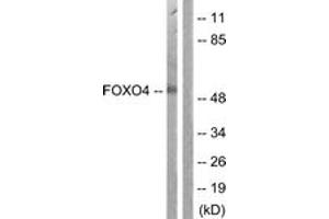 Western Blotting (WB) image for anti-Forkhead Box O4 (FOXO4) (AA 417-466) antibody (ABIN2888912) (FOXO4 antibody  (AA 417-466))