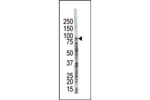 Image no. 1 for anti-Ubiquitin Specific Peptidase 8 (USP8) (C-Term) antibody (ABIN357537) (USP8 antibody  (C-Term))