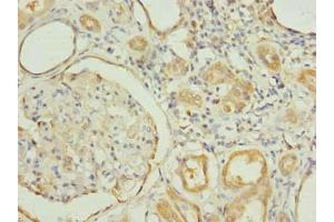 Immunohistochemistry of paraffin-embedded human kidney tissue using ABIN7151188 at dilution of 1:100 (RNF31 antibody  (AA 421-700))