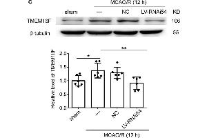 Western Blotting (WB) image for anti-Anoctamin 6 (ANO6) (AA 744-824) antibody (ABIN7436141)