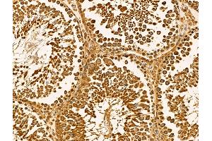ABIN6262098 and ABIN6269010 at 1/100 staining Rat testis tissue by IHC-P. (HSPA9 antibody  (C-Term))