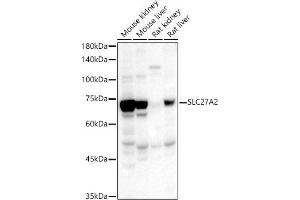Western blot analysis of extracts of various cell lines, using SLC27 antibody (ABIN3021377, ABIN3021378, ABIN1513532 and ABIN6214970) at 1:567 dilution. (SLC27A2 antibody  (AA 30-200))