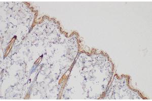 Immunohistochemistry (Paraffin-embedded Sections) (IHC (p)) image for anti-Plasminogen Activator Inhibitor 2 (SERPINB2) antibody (ABIN7234543)